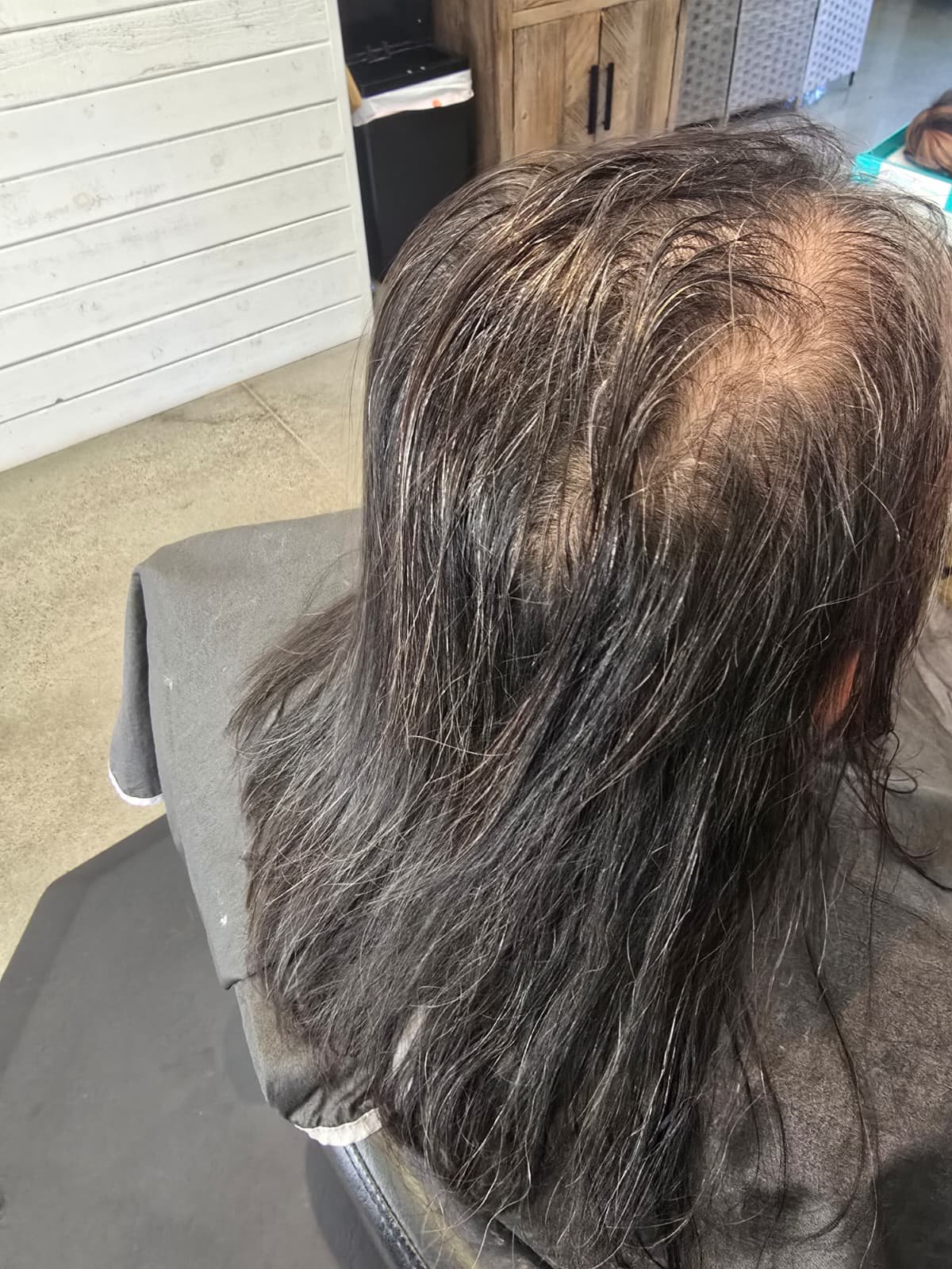 Hair topper before view showing thinning at the crown