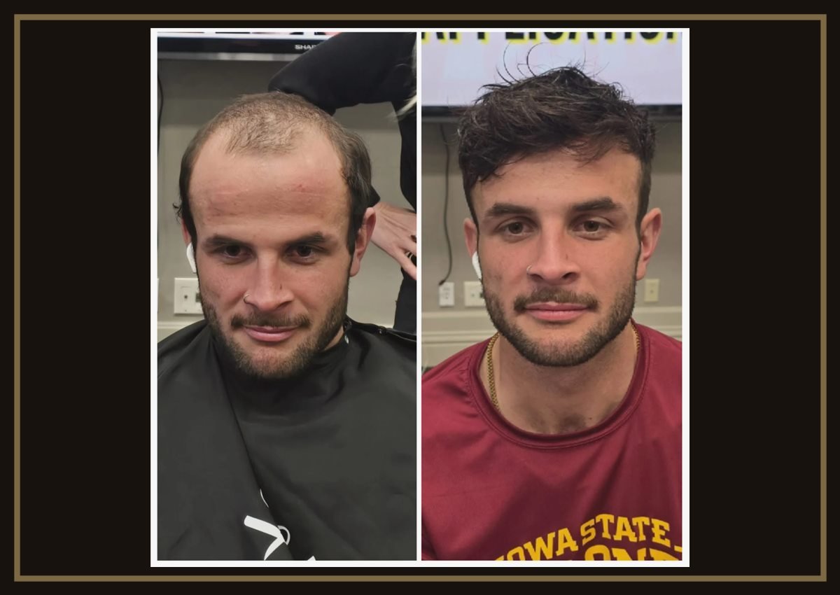 Hair Systems