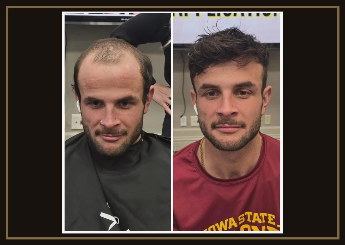 Hair System Maintenance
